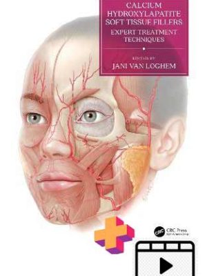 Calcium Hydroxylapatite Soft Tissue Fillers