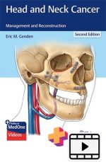 Head and Neck Cancer Management and Reconstruction 2nd Edition-videos