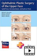 Ophthalmic Plastic Surgery of the Upper Face + videos