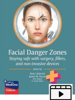 Facial Danger Zones Staying safe with surgery, fillers, and non-invasive devices+videos